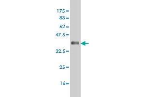 Western Blot detection against Immunogen (36. (CSNK1G1 Antikörper  (AA 293-393))
