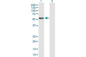Western Blot analysis of IRX2 expression in transfected 293T cell line by IRX2 MaxPab polyclonal antibody. (IRX2 Antikörper  (AA 1-471))
