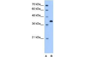 WB Suggested Anti-TOR2A Antibody Titration:  1.