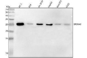 Western blot analysis of SRD5A2 using anti-SRD5A2 antibody (ABIN7606375).