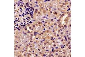 Immunohistochemical analysis of Pancreatic Lipase staining in rat kidney formalin fixed paraffin embedded tissue section. (PNLIP Antikörper)