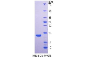 SDS-PAGE (SDS) image for Aquaporin 1 (Colton Blood Group) (AQP1) (AA 78-229) protein (His tag) (ABIN6238636)