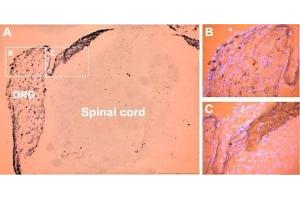 Expression of P2X3 Receptor in rat DRG neurons - Immunohistochemical staining of rat dorsal root ganglion (DRG) neurons with Anti-P2X3 Receptor Antibody (ABIN7043420, ABIN7045090 and ABIN7045091), (A). (P2X3 Receptor (AA 383-397), (C-Term), (Intracellular) Antikörper)