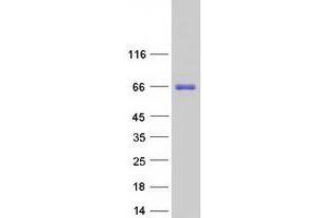 Validation with Western Blot (BTBD9 Protein (Transcript Variant 3) (Myc-DYKDDDDK Tag))
