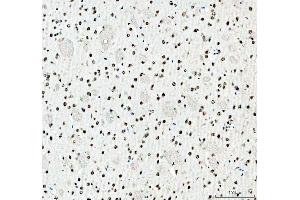 IHC analysis of SFPQ using anti-SFPQ antibody (ABIN7603089). (SFPQ Antikörper  (Middle Region))