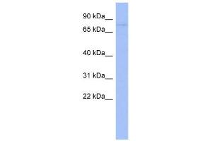 WB Suggested Anti-ZNF219 Antibody Titration:  0. (ZNF219 Antikörper  (Middle Region))