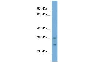 Host:  Rabbit  Target Name:  TRIM51  Sample Type:  293T Whole cell lysates  Antibody Dilution:  1.