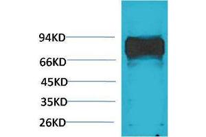 Western Blotting (WB) image for anti-V-Raf-1 Murine Leukemia Viral Oncogene Homolog 1 (RAF1) antibody (ABIN3181567)