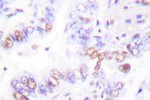 Image no. 1 for anti-X-Ray Repair Complementing Defective Repair in Chinese Hamster Cells 3 (XRCC3) antibody (ABIN271981) (XRCC3 Antikörper)