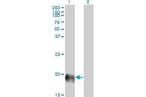 Western Blot analysis of ESM1 expression in transfected 293T cell line by ESM1 monoclonal antibody (M02), clone 6D4. (ESM1 Antikörper  (AA 85-184))