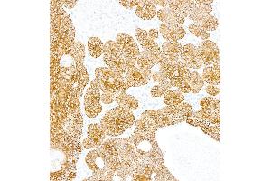 Immunohistochemistry (IHC) image for anti-Keratin 5 (KRT5) (C-Term) antibody (ABIN7795755) (Rekombinanter Cytokeratin 5 Antikörper  (C-Term))