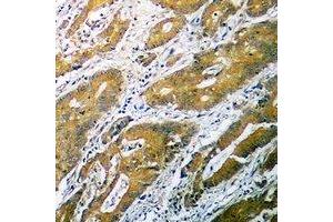 Immunohistochemistry (IHC) image for anti-UDP-Gal:betaGlcNAc beta 1,4 Galactosyltransferase, Polypeptide 1 (B4GALT1) (C-Term) antibody (ABIN7303196)