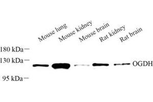Western blot analysis of OGDH (ABIN7073017) at dilution of 1: 300