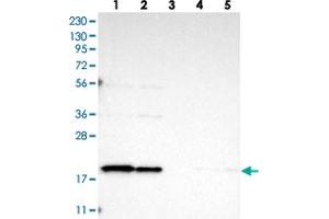 Western blot analysis of Lane 1: RT-4, Lane 2: U-251 MG, Lane 3: Human Plasma, Lane 4: Liver, Lane 5: Tonsil with TIMM17B polyclonal antibody . (TIMM17B Antikörper)