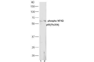 Lane 1: Mouse lung lysates Lane 2: Mouse spleen lysates probed with Rabbit Anti-NFkB p65 (Thr254) Polyclonal Antibody, Unconjugated (ABIN712886) at 1:300 overnight at 4˚C. (NF-kB p65 Antikörper  (pThr254))