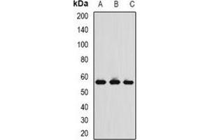 Western blot analysis of TCP1-delta expression in MCF7 (A), THP1 (B), mouse spleen (C) whole cell lysates. (CCT4 Antikörper)