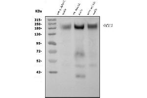 Western blot analysis of CACNA1S using anti-CACNA1S antibody (ABIN7600160).