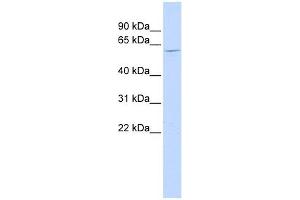 NT5C1B antibody used at 1 ug/ml to detect target protein. (NT5C1B Antikörper  (N-Term))