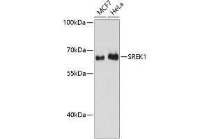 Western blot analysis of extracts of various cell lines, using SREK1 antibody (ABIN6132836, ABIN6148434, ABIN6148435 and ABIN6217160) at 1:3000 dilution. (SFRS12 Antikörper  (AA 1-180))