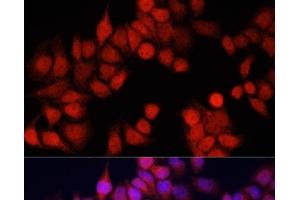 Immunofluorescence analysis of HeLa cells using CSTB Polyclonal Antibody at dilution of 1:100. (CSTB Antikörper)
