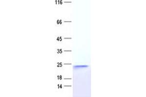 Western Blotting (WB) image for Fast Skeletal Troponin C (TNNC2) protein (DYKDDDDK Tag) (ABIN2732107)