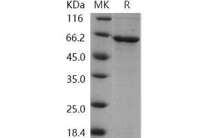 Western Blotting (WB) image for Cyclin Dependent Kinase Like 2 (CDKL2) protein (His tag) (ABIN7195300) (CDKL2 Protein (His tag))
