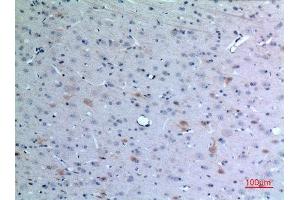 Immunohistochemistry (IHC) analysis of paraffin-embedded Rat Brain, antibody was diluted at 1:100. (CCL26 Antikörper  (Internal Region))