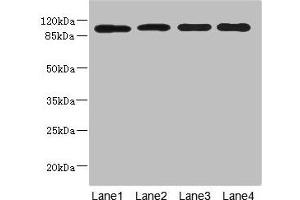 Western blot All lanes: USP26 antibody at 5. (USP26 Antikörper  (AA 664-913))