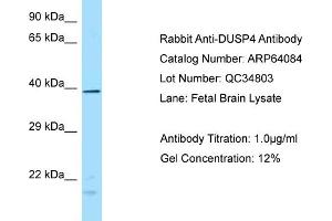 Western Blotting (WB) image for anti-Dual Specificity Phosphatase 4 (DUSP4) (N-Term) antibody (ABIN2789727) (DUSP4 Antikörper  (N-Term))