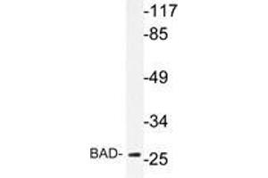Western blot analysis of BAD antibody in extracts from NIH/3T3 cells. (BAD Antikörper)