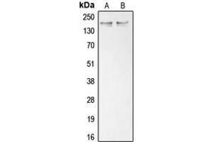 Western blot analysis of Collagen 11 alpha 1 expression in K562 (A), Saos2 (B) whole cell lysates.