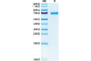 Mouse LIF on Tris-Bis PAGE under reduced condition. (LIF Protein (AA 25-203) (Fc Tag))