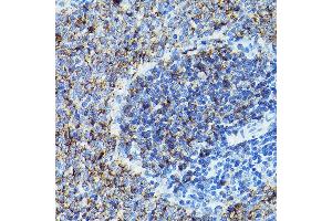 Immunohistochemistry of paraffin-embedded rat spleen using CD79B Rabbit pAb (ABIN3022745, ABIN3022746, ABIN3022747 and ABIN6219206) at dilution of 1:100 (40x lens). (CD79b Antikörper  (AA 29-159))