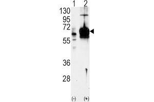 Western Blotting (WB) image for anti-Guanylate Cyclase 1 Soluble Subunit Alpha (GUCY1A1) antibody (ABIN3003008) (GUCY1A1 Antikörper)