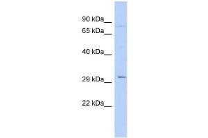 WB Suggested Anti-PITX2 Antibody Titration:  0. (PITX2 Antikörper  (N-Term))