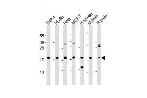 All lanes : Anti-ARPC5 Antibody (Center) at 1:2000 dilution Lane 1: THP-1 whole cell lysate Lane 2: HL-60 whole cell lysate Lane 3: Hela whole cell lysate Lane 4: MCF-7 whole cell lysate Lane 5: Human spleen lysate Lane 6: Mouse brain lysate Lane 7: Rat brain lysate Lysates/proteins at 20 μg per lane. (ARPC5 Antikörper  (AA 67-101))
