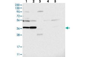 Western blot analysis of Lane 1: RT-4, Lane 2: U-251 MG, Lane 3: Human Plasma, Lane 4: Liver, Lane 5: Tonsil with PRUNE2 polyclonal antibody  at 1:250-1:500 dilution.