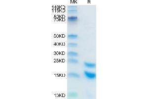 Human CCL5 on Tris-Bis PAGE under reduced condition. (CCL5 Protein (AA 24-91) (His tag,SUMO Tag))