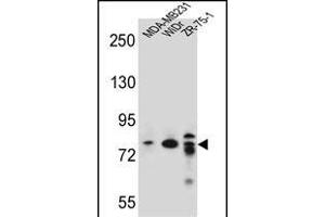 ARHG Antibody (C-term) (ABIN656937 and ABIN2846128) western blot analysis in MDA-M,WiDr,ZR-75-1 cell line lysates (35 μg/lane). (ARHGAP22 Antikörper  (C-Term))