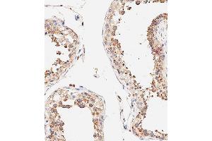 Immunohistochemical analysis of paraffin-embedded human testis tissue using B performed on the Leica® BOND RXm. (DLL3 Antikörper  (C-Term))