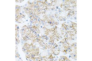 Immunohistochemistry of paraffin-embedded human stomach using IL17A antibody (ABIN6290529) at dilution of 1:100 (40x lens). (Interleukin 17a Antikörper)