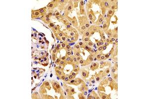 (ABIN6242522 and ABIN6577190) staining PGK1 in human kidney tissue sections by Immunohistochemistry (IHC-P - paraformaldehyde-fixed, paraffin-embedded sections). (PGK1 Antikörper  (AA 1-417))