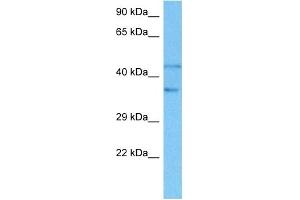 Host:  Rat  Target Name:  SMAD2  Sample Tissue:  Rat Liver  Antibody Dilution:  1ug/ml (SMAD2 Antikörper  (N-Term))