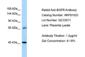 Western Blotting (WB) image for anti-Epidermal Growth Factor Receptor (EGFR) (Middle Region) antibody (ABIN2788648) (EGFR Antikörper  (Middle Region))