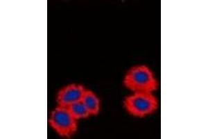 Immunofluorescent analysis of CPI17 staining in Jurkat cells. (CPI-17 Antikörper  (N-Term))
