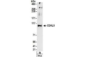 Western Blotting (WB) image for anti-Cyclin-Dependent Kinase-Like 5 (CDKL5) (AA 350-400) antibody (ABIN7453908)