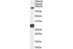 Image no. 1 for anti-Forkhead Box P2 (FOXP2) (Internal Region) antibody (ABIN375200) (FOXP2 Antikörper  (Internal Region))