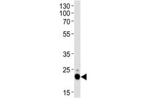 Western Blotting (WB) image for anti-CD9 (CD9) (AA 115-145) antibody (ABIN3028557)