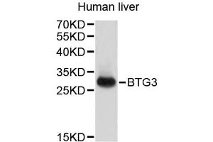 Western blot analysis of extracts of human liver, using BTG3 antibody (ABIN3048296).