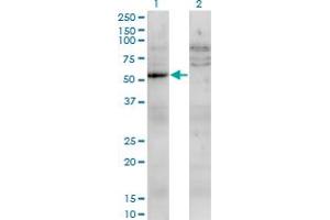 Western Blot analysis of UMPS expression in transfected 293T cell line by UMPS monoclonal antibody (M05), clone 2F5. (UMPS Antikörper  (AA 381-479))